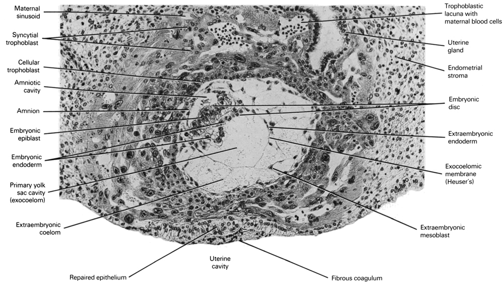 amnion, amniotic cavity, cytotrophoblast, embryonic disc, embryonic endoderm, endometrial epithelium, endometrial stroma, epiblast, exocoelomic (Heuser's) membrane, extra-embryonic endoderm, extra-embryonic mesoblast, fibrous coagulum, maternal blood cells in trophoblast lacuna, primary yolk sac cavity (exocoelom), sinusoid, syncytiotrophoblast, uterine cavity, uterine gland