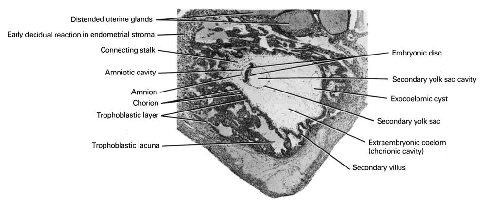 amnion, amniotic cavity, chorion, chorionic cavity, connecting stalk, decidual reaction, embryonic disc, endometrial stroma, exocoelomic cyst, extra-embryonic coelom, secondary umbilical vesicle, secondary umbilical vesicle cavity, secondary villus, trophoblast lacunae, trophoblastic layer, uterine gland