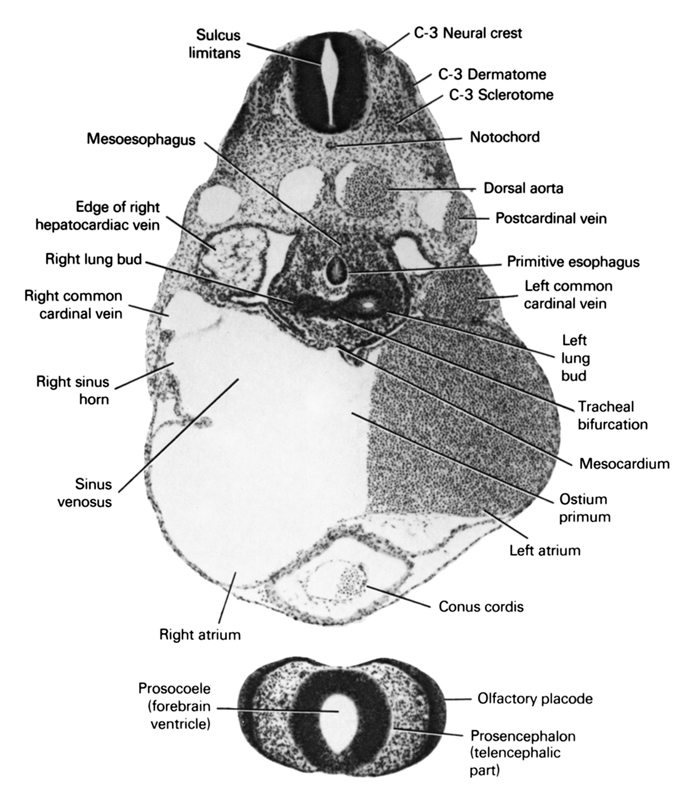 C-3 dermatome, C-3 neural crest, C-3 sclerotome, conus cordis, dorsal aorta, edge of right hepatocardiac vein, left atrium, left common cardinal vein, left lung bud, mesocardium, mesoesophagus, notochord, olfactory placode, ostium primum, postcardinal vein, primitive esophagus, prosencephalon (telencephalic part), prosocoele (forebrain ventricle), right atrium, right common cardinal vein, right horn of sinus venosus, right lung bud, sinus venosus, sulcus limitans, tracheal bifurcation