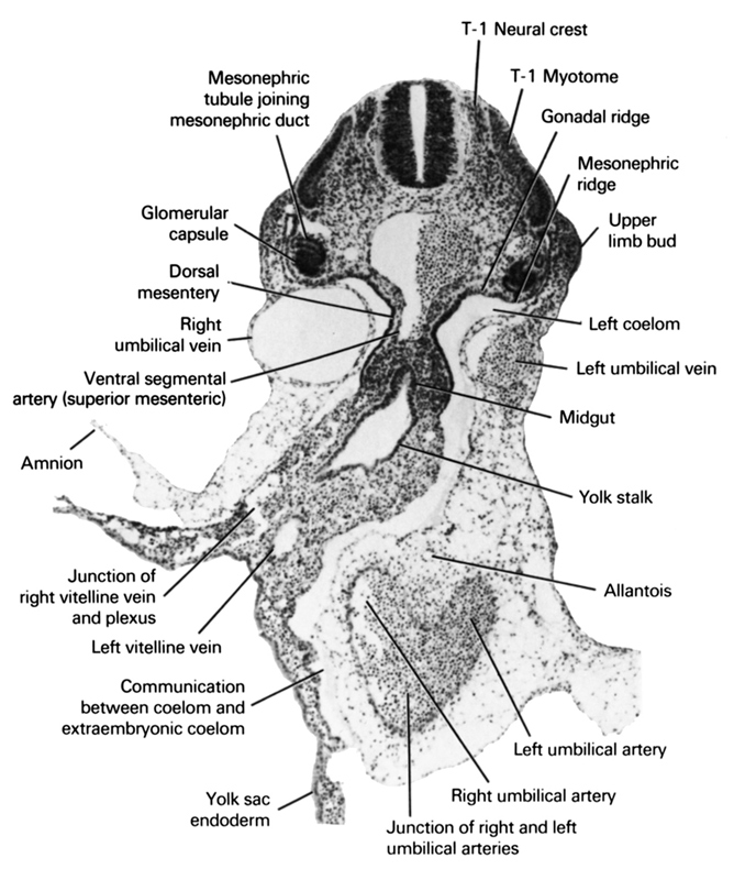 T-1 myotome, T-1 neural crest, allantois, amnion, communication between coelom and extraembryonic coelom, dorsal mesentery, glomerular capsule, gonadal ridge, junction of right and left umbilical arteries, junction of right vitelline vein and plexus, left coelom, left umbilical artery, left umbilical vein, left vitelline (omphalomesenteric) vein, mesonephric ridge, mesonephric tubule joining mesonephric duct, midgut, right umbilical artery, right umbilical vein, upper limb bud, ventral segmental artery (superior mesenteric), yolk sac endoderm, yolk stalk