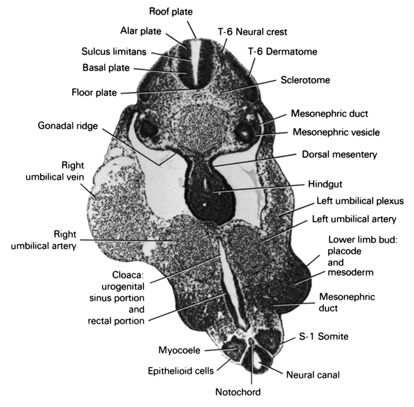 S-1 somite, T-6 dermatome, T-6 neural crest, alar plate, basal plate, cloaca urogenital sinus portion and rectal portion, dorsal mesentery, epithelioid cells, floor plate, gonadal ridge, hindgut, left umbilical artery, left umbilical plexus, lower limb bud: placode and mesoderm, mesonephric duct, mesonephric vesicle, myocoele, neural canal, notochord, right umbilical artery, right umbilical vein, roof plate, sclerotome, sulcus limitans