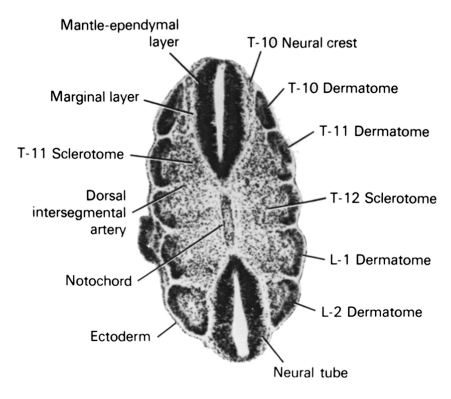 L-1 dermatome, L-2 dermatome, T-10 dermatome, T-10 neural crest, T-11 dermatome, T-11 sclerotome, T-12 sclerotome, dorsal intersegmental artery, ectoderm, mantle-ependymal layer, marginal layer, neural tube, notochord