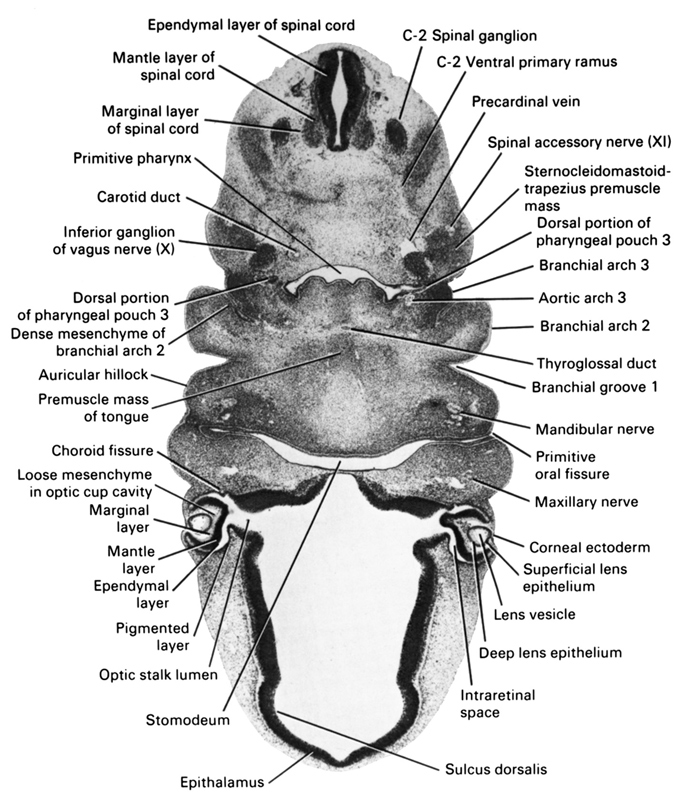 C-2 spinal ganglion, C-2 ventral primary ramus, aortic arch 3, auricular hillock, branchial arch 2, branchial arch 3, branchial groove 1, carotid duct, choroid fissure, corneal ectoderm, deep lens epithelium, dense mesenchyme of branchial arch 2, dorsal portion of pharyngeal pouch 3, ependymal layer, ependymal layer of spinal cord, epithalamus, inferior ganglion of vagus nerve (CN X), intraretinal space (optic vesicle cavity), lens vesicle, loose mesenchyme in optic cup cavity, mandibular nerve, mantle layer, mantle layer of spinal cord, marginal layer, marginal layer of spinal cord, maxillary nerve (CN V₂), maxillary vein, optic stalk lumen, pigmented layer of retina, precardinal vein, premuscle mass of tongue, primitive oral fissure, primitive pharynx, spinal accessory nerve (CN XI), sternocleidomastoid / trapezius premuscle mass, stomodeum, sulcus dorsalis, superficial lens epithelium, thyroglossal duct