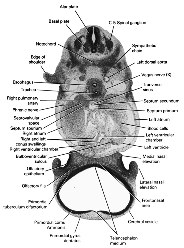 C-5 spinal ganglion, alar plate, basal plate, blood cells, bulboventricular sulcus, cerebral vesicle, edge of shoulder, esophagus, frontonasal area, lateral nasal elevation, left atrium, left dorsal aorta, left ventricle, left ventricular chamber, medial nasal elevation, notochord, olfactory epithelium, olfactory filia (CN I), phrenic nerve, primary interatrial septum (septum primum), primordial cornu Ammonis, primordial gyrus dentatus, primordial tuberculum olfactorium, right and left conus swellings, right atrium, right pulmonary artery, right ventricular chamber, septovalvular space, septum secundum, septum spurium, sympathetic chain, telencephalon medium, trachea, transverse sinus, vagus nerve (CN X)