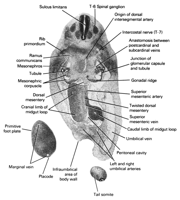 T-6 spinal ganglion, anastomosis between postcardinal and subcardinal veins, caudal limb of midgut loop, cranial limb of midgut loop, dorsal mesentery, gonadal ridge, infraumbilical area of body wall, intercostal nerve (T-7), junction of glomerular capsule and tubule, left and right umbilical arteries, marginal vein, mesonephric corpuscle, mesonephros, origin of dorsal intersegmental artery, peritoneal cavity, placode, primitive foot plate, ramus communicans, rib primordium, sulcus limitans, superior mesenteric artery, superior mesenteric vein, tail somite, tubule, twisted dorsal mesentery, umbilical vein