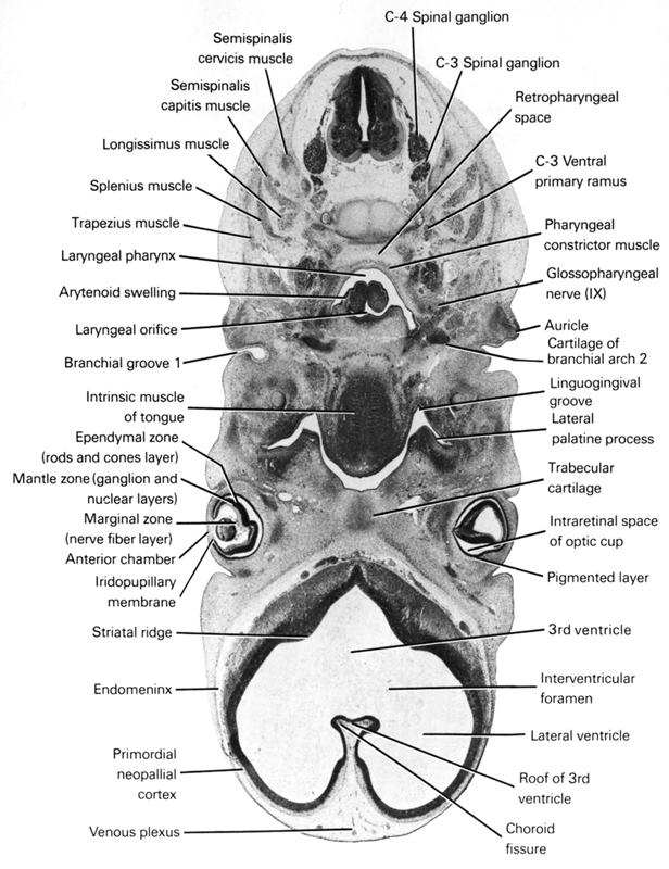 C-3 spinal ganglion, C-3 ventral primary ramus, C-4 spinal ganglion, anterior chamber, arytenoid swelling, auricle, cartilage of branchial arch 2, choroid fissure, endomeninx, ependymal zone (rods and cones layer), glossopharyngeal nerve (CN IX), interventricular foramen, intraretinal space of optic cup, intrinsic muscle of tongue, iridopupillary membrane, laryngeal orifice, laryngeal pharynx, lateral palatine process, lateral ventricle, linguogingival groove, longissimus muscle, mantle zone (ganglion and nuclear layers), marginal zone (nerve fiber layer), pharyngeal constrictor muscle, pharyngeal groove 1, pigmented layer of retina, primordial neopallial cortex, retropharyngeal space, roof of 3rd ventricle, semispinalis capitis muscle, semispinalis cervicis muscle, splenius muscle, striatal ridge, third ventricle, trabecular cartilage, trapezius muscle, venous plexus(es)