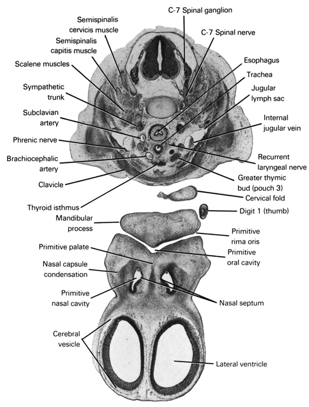 C-7 spinal ganglion, C-7 spinal nerve, brachiocephalic artery, cerebral vesicle, cervical fold, clavicle, digit 1 (thumb), esophagus, greater thymic bud (pouch 3), internal jugular vein, jugular lymph sac, lateral ventricle, mandibular prominence of pharyngeal arch 1, nasal capsule condensation, nasal septum, phrenic nerve, primitive nasal cavity, primitive oral cavity, primitive palate, primitive rima oris, recurrent laryngeal nerve, scalene muscles, semispinalis capitis muscle, semispinalis cervicis muscle, subclavian artery, sympathetic trunk, thyroid isthmus, trachea