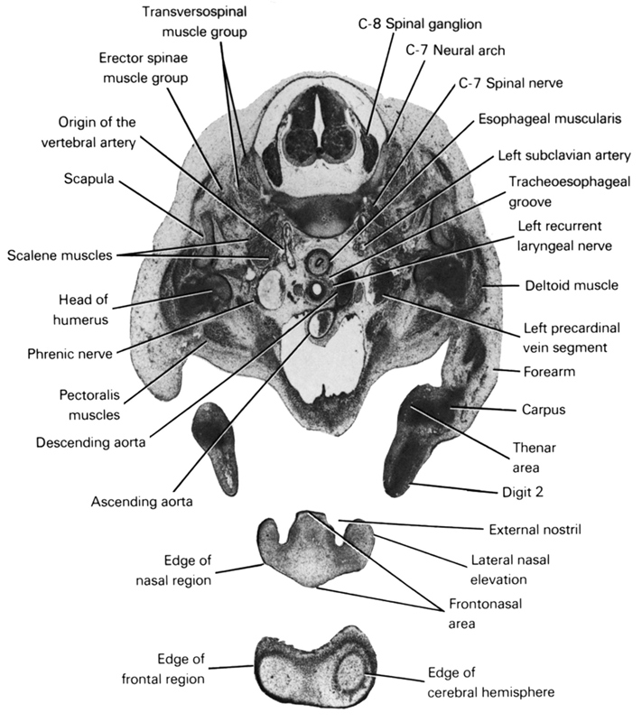 C-7 neural arch, C-7 spinal nerve, C-8 spinal ganglion, ascending aorta, carpus, deltoid muscle, descending aorta, digit 2, edge of cerebral hemisphere, edge of frontal region, edge of nasal region, erector spinae muscle group, esophageal muscularis, external nostril, forearm, frontonasal area, head of humerus, lateral nasal elevation, left precardinal vein segment, left recurrent laryngeal nerve, left subclavian artery, origin of the vertebral artery, pectoralis muscles, phrenic nerve, scalene muscles, scapula, thenar area, tracheo-esophageal groove, transversospinal muscle group