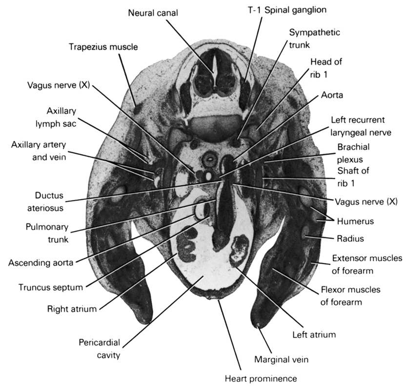 T-1 spinal ganglion, aorta, ascending aorta, axillary artery, axillary lymph sac, axillary vein, brachial plexus, ductus arteriosus, extensor muscles of forearm, flexor muscles of forearm, head of rib 1, heart prominence, humerus, left atrium, left recurrent laryngeal nerve, marginal vein, neural canal, pericardial cavity, pulmonary trunk, radius, right atrium, shaft of rib 1, sympathetic trunk, trapezius muscle, truncus septum, vagus nerve (CN X)