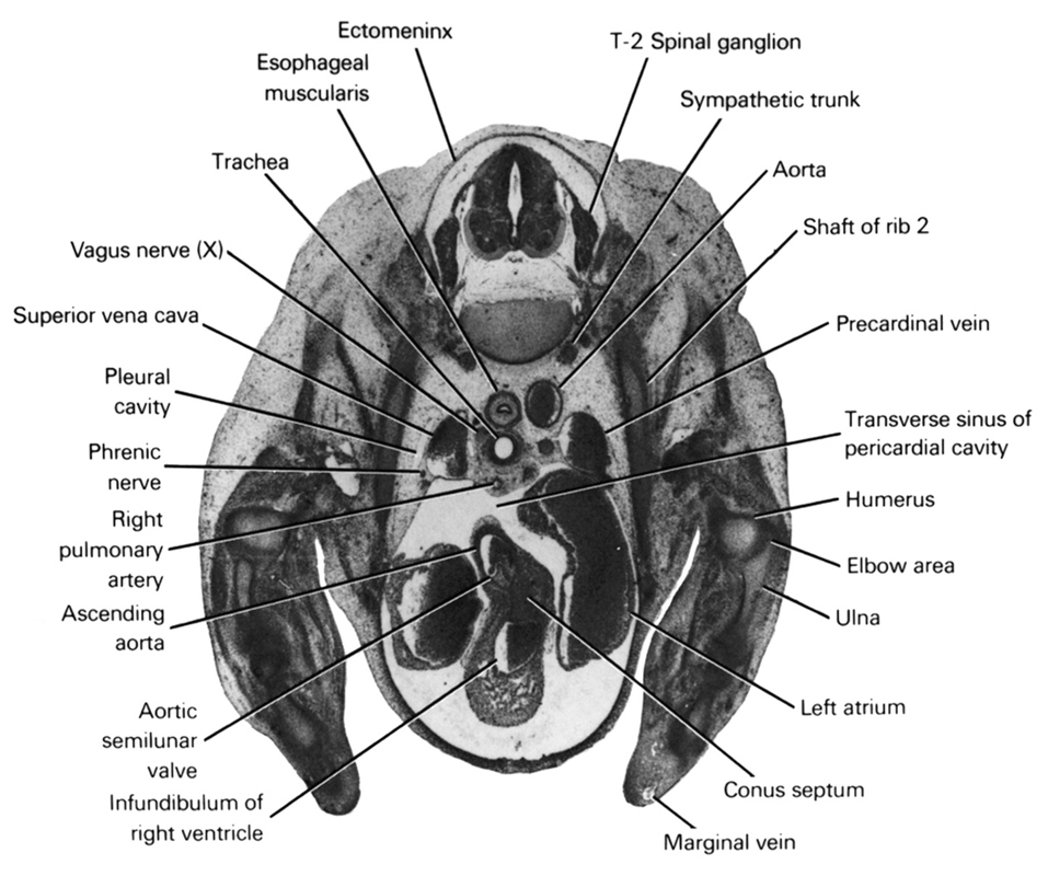 T-2 spinal ganglion, aorta, aortic semilunar valve, ascending aorta, conus septum, ectomeninx, elbow area, esophageal muscularis, humerus, infundibulum of right ventricle, left atrium, marginal vein, phrenic nerve, pleural cavity, precardinal vein, right pulmonary artery, shaft of rib 2, superior vena cava, sympathetic trunk, trachea, transverse sinus of pericardial cavity, ulna, vagus nerve (CN X)