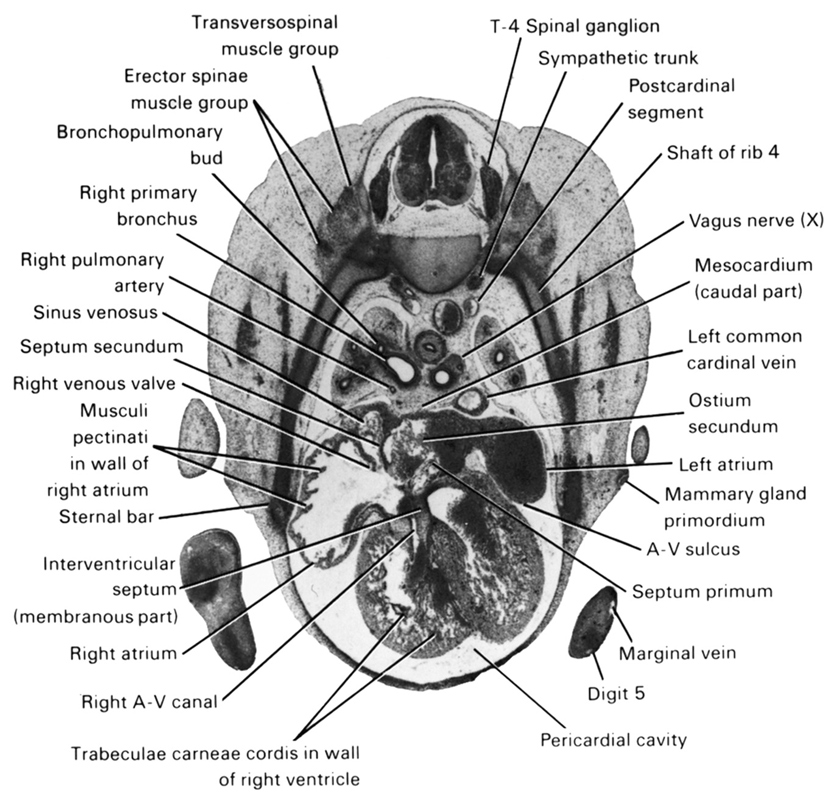 T-4 spinal ganglion, atrioventricular sulcus, bronchopulmonary bud(s), digit 5, erector spinae muscle group, interventricular septum (membranous part), left atrium, left common cardinal vein, mammary gland primordium, marginal vein, mesocardium (caudal part), musculi pectinati in wall of right atrium, ostium secundum, pericardial cavity, postcardinal segment, right atrioventricular canal, right atrium, right primary bronchus, right pulmonary artery, right venous valve, septum primum, septum secundum, shaft of rib 4, sinus venosus, sternal bar, sympathetic trunk, trabeculae carneae cordis in wall of right ventricle, transversospinal muscle group, vagus nerve (CN X)