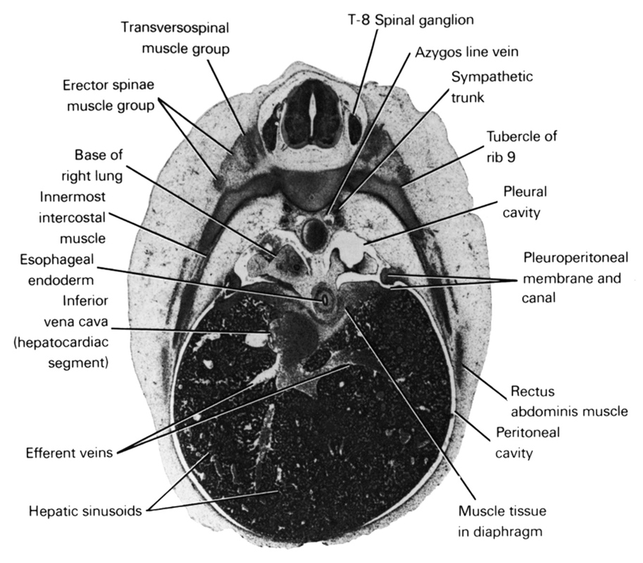 T-8 spinal ganglion, azygos vein, base of right lung, efferent veins, erector spinae muscle group, esophageal endoderm, hepatic sinusoids, inferior vena cava (hepatocardiac segment), innermost intercostal muscle(s), muscle tissue in diaphragm, peritoneal cavity, pleural cavity, pleuroperitoneal membrane and canal, rectus abdominis muscle, sympathetic trunk, transversospinal muscle group, tubercle of rib 9