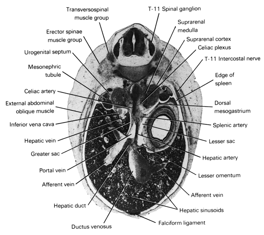 T-11 intercostal nerve, T-11 spinal ganglion, afferent vein, celiac artery, celiac plexus, dorsal mesogastrium, ductus venosus, edge of spleen, erector spinae muscle group, external abdominal oblique muscle, falciform ligament, greater sac, hepatic artery, hepatic duct(s), hepatic sinusoids, hepatic vein(s), inferior vena cava, lesser omentum, lesser sac, mesonephric tubule(s), portal vein, splenic artery, suprarenal cortex, suprarenal medulla, transversospinal muscle group, urogenital septum