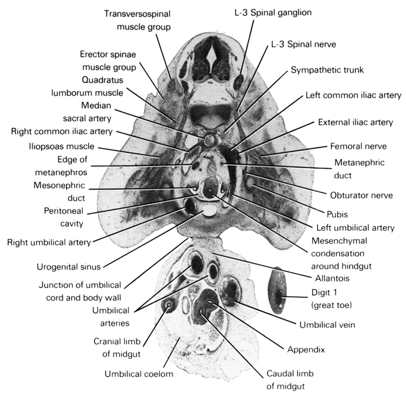 L-3 spinal ganglion, L-3 spinal nerve, allantois, appendix, caudal limb of midgut, cranial limb of midgut, digit 1 (great toe), edge of metanephros, erector spinae muscle group, external iliac artery, femoral nerve, iliopsoas muscle, junction of umbilical cord and body wall, left common iliac artery, left umbilical artery, median sacral artery, mesenchymal condensation around hindgut, mesonephric duct, metanephric duct, obturator nerve, peritoneal cavity, pubis, quadratus lumborum muscle, right common iliac artery, right umbilical artery, sympathetic trunk, transversospinal muscle group, umbilical arteries, umbilical coelom, umbilical vein, urogenital sinus