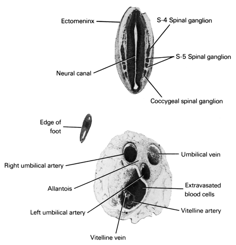 S-4 spinal ganglion, S-5 spinal ganglion, allantois, coccygeal spinal ganglion, ectomeninx, edge of foot, extravasated blood cells, left umbilical artery, neural canal, right umbilical artery, umbilical vein, vitelline (omphalomesenteric) artery, vitelline (omphalomesenteric) vein