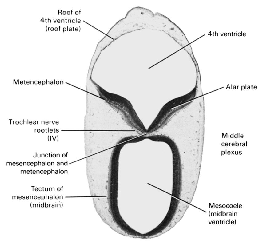 alar plate(s), junction of mesencephalon and metencephalon, mesocoele (midbrain ventricle), metencephalon, middle cerebral plexus, rhombencoel (fourth ventricle), roof of rhombencoel (fourth ventricle), tectum of mesencephalon (midbrain), trochlear nerve rootlets (CN IV)