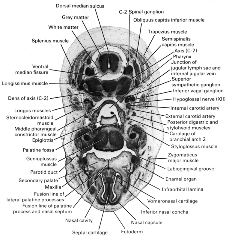 C-1 vertebra (atlas), C-2 spinal ganglion, cartilage of pharyngeal arch 2, dens of C-2 vertebra (axis), dorsal median sulcus, ectoderm, enamel organ, epiglottis, external carotid artery, fusion line of lateral palatine processes, fusion line of palatine process and nasal septum, genioglossus muscle, grey matter, hypoglossal nerve (CN XII), inferior ganglion of vagus nerve (CN X), inferior nasal concha, infra-orbital lamina, internal carotid artery, junction of internal jugular vein and jugular lymph sac, labiogingival groove, longissimus muscle, longus muscles, maxilla, middle pharyngeal constrictor muscle, nasal capsule, nasal cavity (nasal sac), obliquus capitis inferior muscle, palatine fossa, parotid duct, pharynx, posterior digastric and stylohyoid muscles, secondary palate, semispinalis capitis muscle, septal cartilage, splenius muscle, sternocleidomastoid muscle, styloglossus muscle, superior sympathetic ganglion, trapezius muscle, ventral median fissure, vomeronasal cartilage, white matter, zygomaticus major muscle