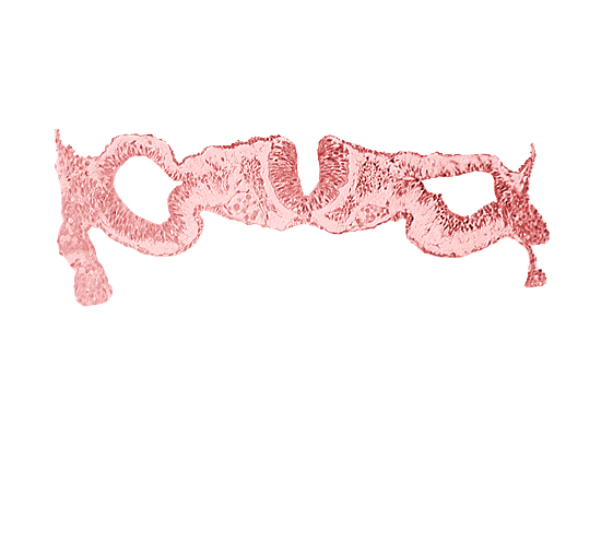 dorsal aorta, junction of neural ectoderm and surface ectoderm, junction of neural fold and surface ectoderm, midgut, neural fold [rhombencephalon (Rh. D)], notochordal plate, primordial peritoneal cavity, somite 1 (O-1)