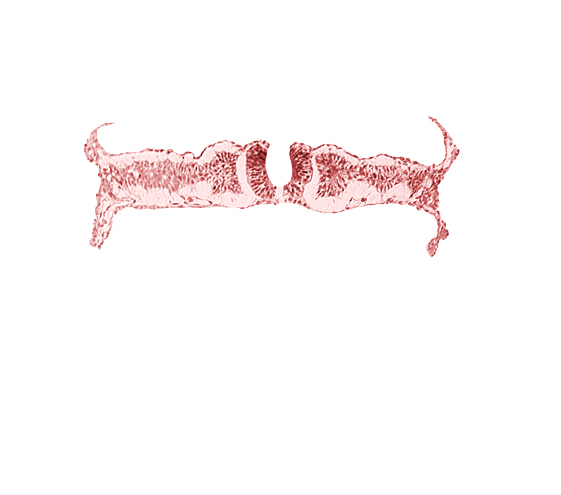 amnion attachment, amniotic cavity, caudal neuropore, dorsal aorta, extra-embryonic coelom, midgut, nephrogenic cord, right umbilical vein, somite 6 (C-2), somitocoel 6, umbilical vesicle cavity, umbilical vesicle wall