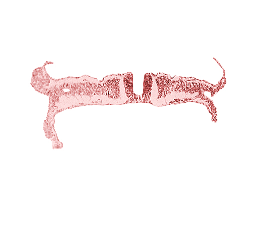 caudal neuropore, communication between primordial peritoneal cavity and extra-embryonic coelom, dorsal aorta, extra-embryonic coelom, primordial peritoneal cavity, somite 7 (C-3), somitocoel 7