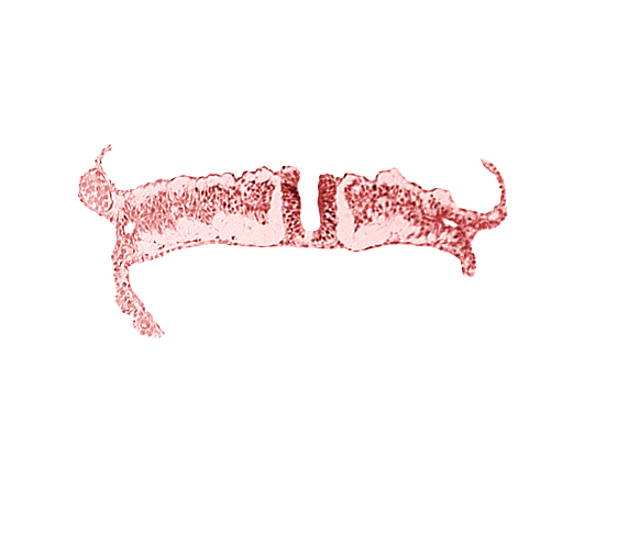 dorsal aorta, embryonic endoderm, embryonic surface ectoderm, extra-embryonic coelom, extra-embryonic ectoderm, extra-embryonic endoderm, extra-embryonic mesoderm, intermediate mesenchyme, lateral plate mesoderm, paraxial mesoderm, primordial peritoneal cavity