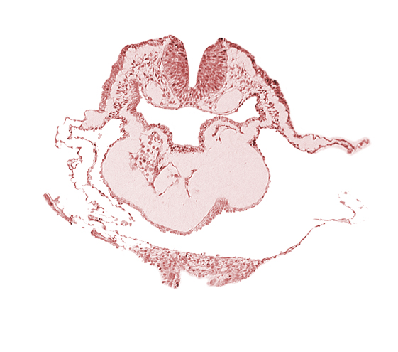 artifact separation(s), bulbis cordis, caudal edge of aortic arch 1, dorsal aorta, epimyocardium, lateral pharyngeal recess, left bulboventricular sulcus, looped heart, neural fold [rhombencephalon (Rh. B)], notochordal plate