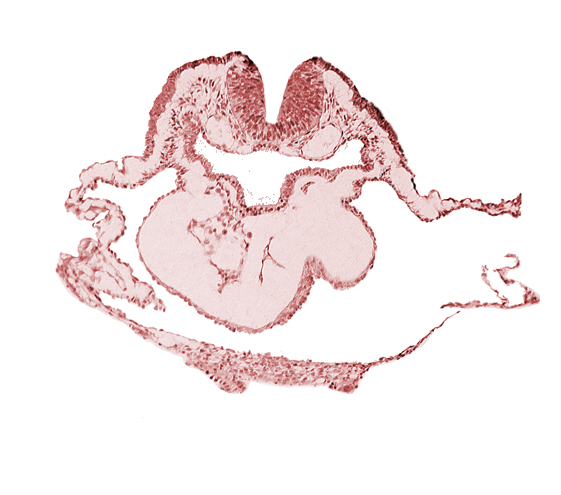 artifact separation(s), bulbis cordis, dorsal aorta, lateral pharyngeal recess, left bulboventricular sulcus, neural fold [rhombencephalon (Rh. B)], notochordal plate, pericardial cavity