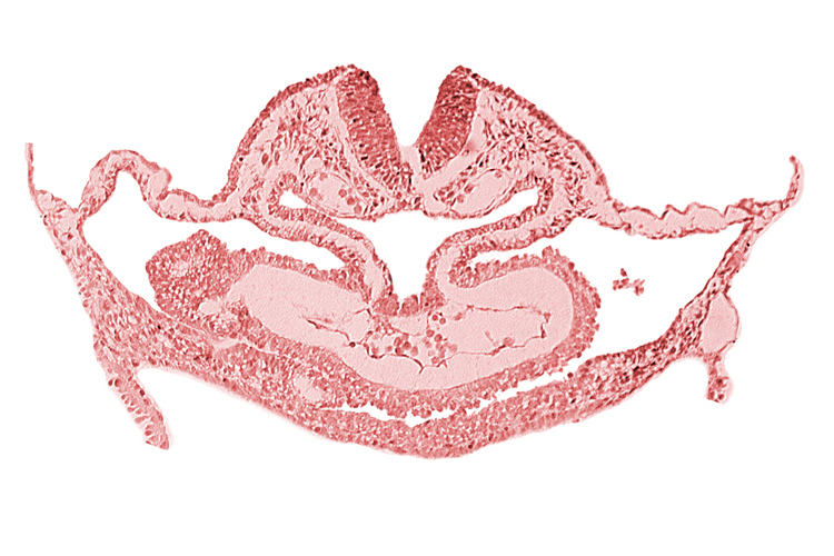 atrial canal, caudal edge of otic placode, dorsal aorta, edge of presumptive left atrium, hepatic plate, neural fold [rhombencephalon (Rh. C)], presumptive left atrium, presumptive right atrium