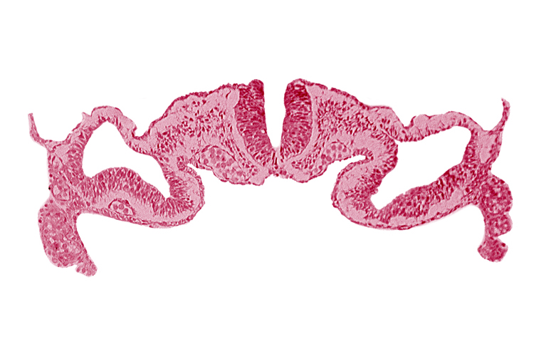 artifact separation(s), dorsal aorta, intermediate mesenchyme, midgut, neural fold [rhombencephalon (Rh. C)], paraxial mesoderm, presumptive right atrium, primordial peritoneal cavity, somatopleure, surface ectoderm, umbilical vesicle cavity