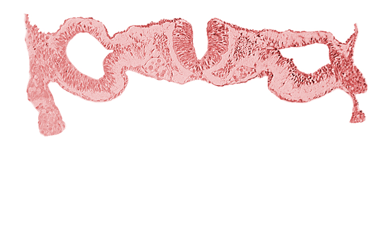 dorsal aorta, junction of neural ectoderm and surface ectoderm, junction of neural fold and surface ectoderm, midgut, neural fold [rhombencephalon (Rh. D)], notochordal plate, primordial peritoneal cavity, somite 1 (O-1)