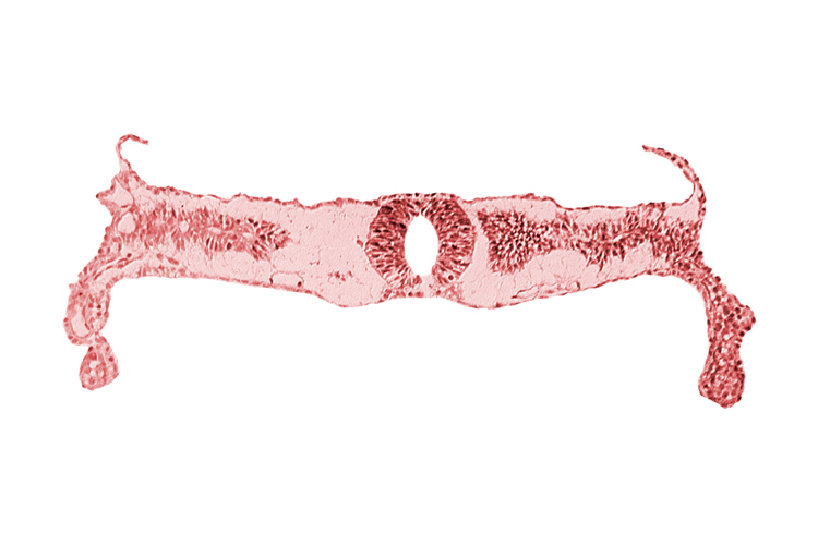 midgut, neural tube [rhombencephalon (Rh. D)], somite 3-4 intersegmental region