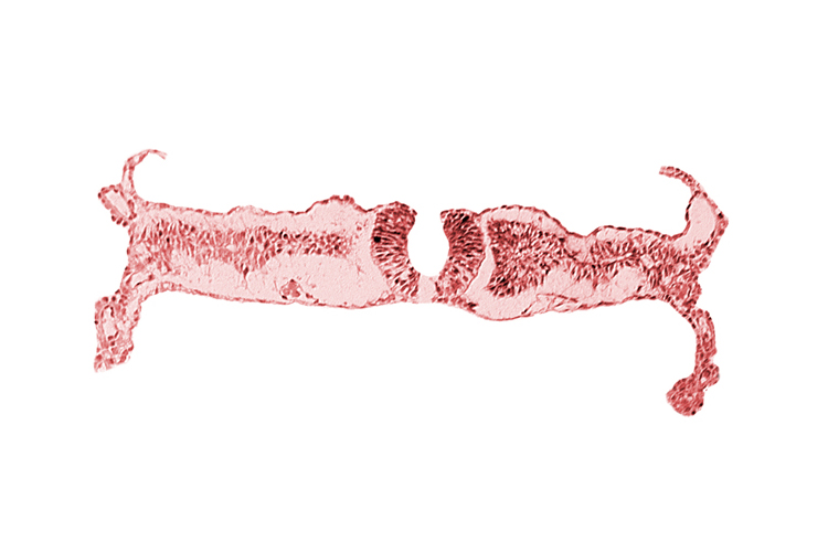 amniotic cavity, artifact separation(s), extra-embryonic coelom, intermediate mesenchyme, midgut, primordial peritoneal cavity, somite 5 (C-1), umbilical vesicle cavity
