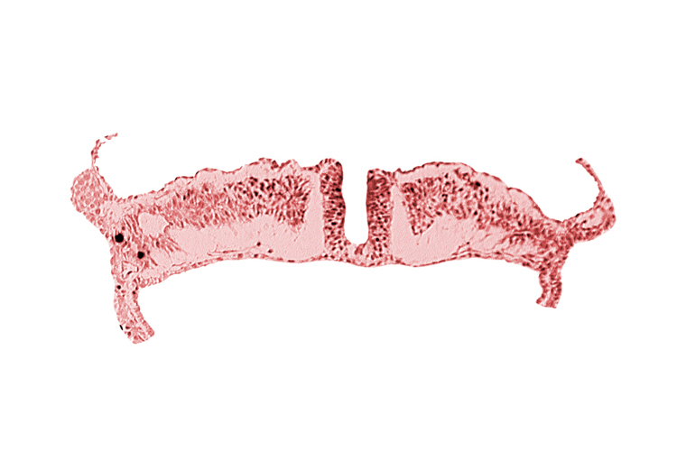 caudal neuropore, dorsal aorta, lateral plate mesoderm, paraxial mesoderm