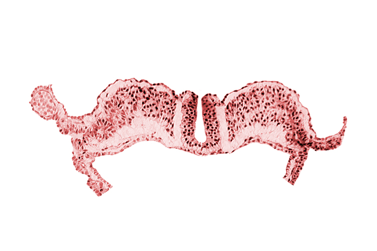 amniotic cavity, communication between primordial peritoneal cavity and extra-embryonic coelom, midgut, notochordal plate
