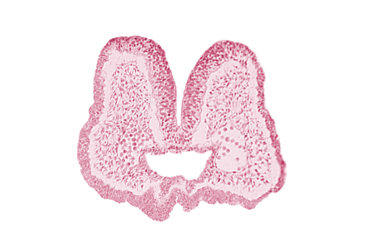 aortic arch 1, artifact space(s), endoderm, foregut, mandibular prominence of pharyngeal arch 1, mesencephalic neural crest, mesenchyme in pharyngeal arch 1, neural fold [mesencephalon (M)], neural groove, nucleated blood cells, prechordal plate (oropharyngeal membrane), stomodeum, surface ectoderm