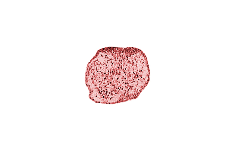 caudal eminence, gastrulation (primitive) streak, neural ectoderm, surface ectoderm of caudal eminence