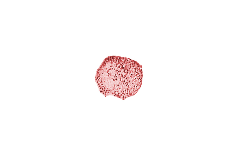 caudal part of caudal eminence