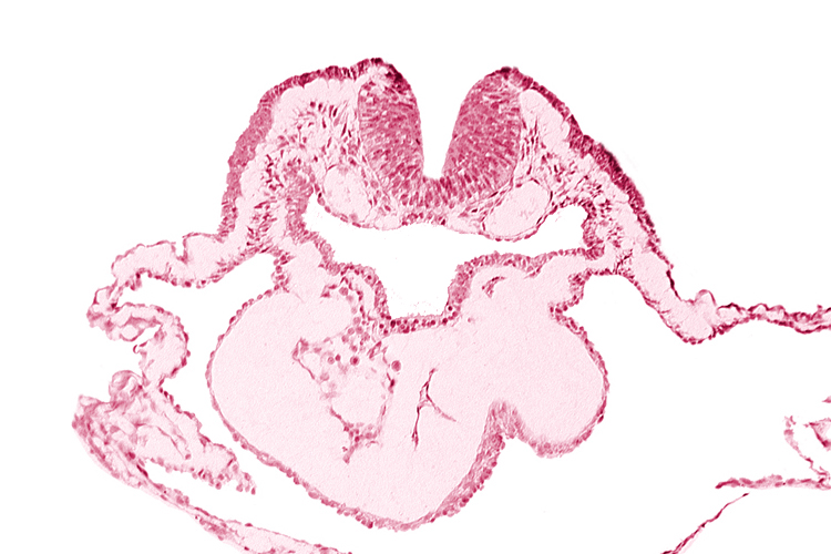artifact separation(s), bulbis cordis, dorsal aorta, lateral pharyngeal recess, left bulboventricular sulcus, neural fold [rhombencephalon (Rh. B)], notochordal plate, pericardial cavity