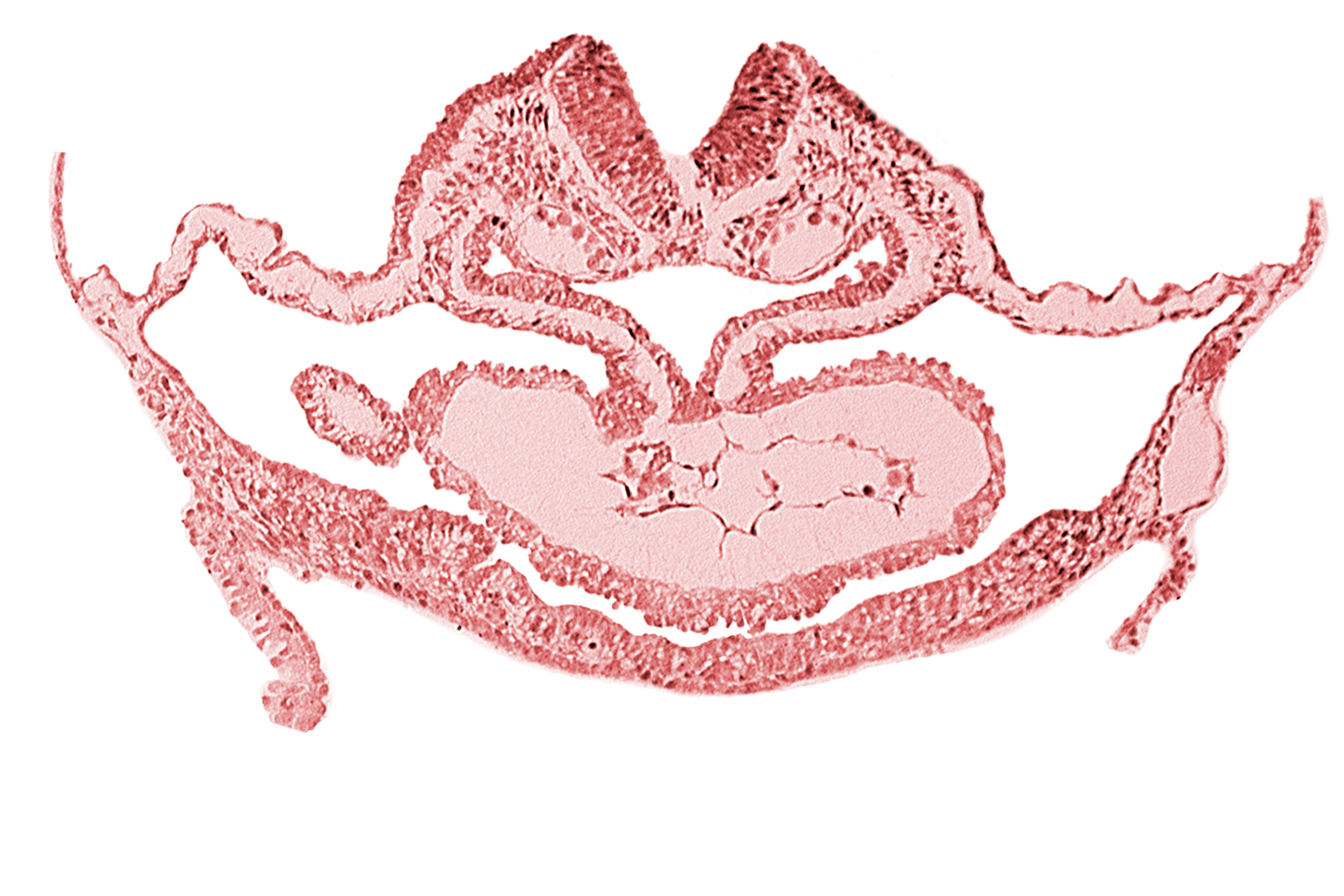 artifact separation(s), atrial canal, cardiac jelly, cephalic edge of hepatic plate, cephalic neuropore, dorsal aorta, otic placode, pericardial cavity, presumptive left ventricle, presumptive right atrium, primordial atrioventricular junction