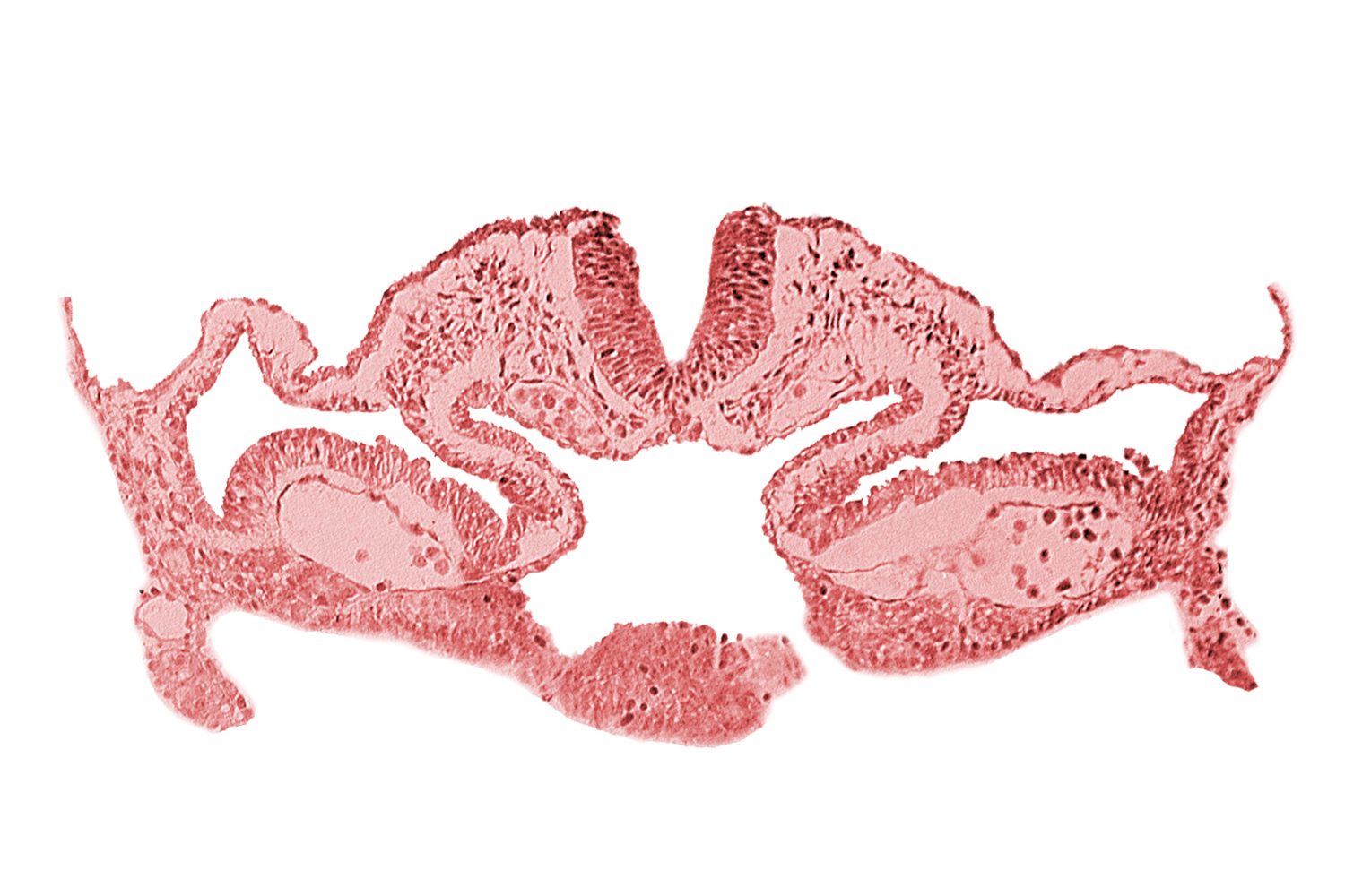 alar plate(s), basal plate, cephalic intestinal portal, dorsal aorta, head mesenchyme, hepatic plate / septum transversum region, neural fold [rhombencephalon (Rh. C)], notochordal plate, presumptive left atrium, presumptive right atrium, primordial pericardioperitoneal canal (pleural cavity), sulcus limitans