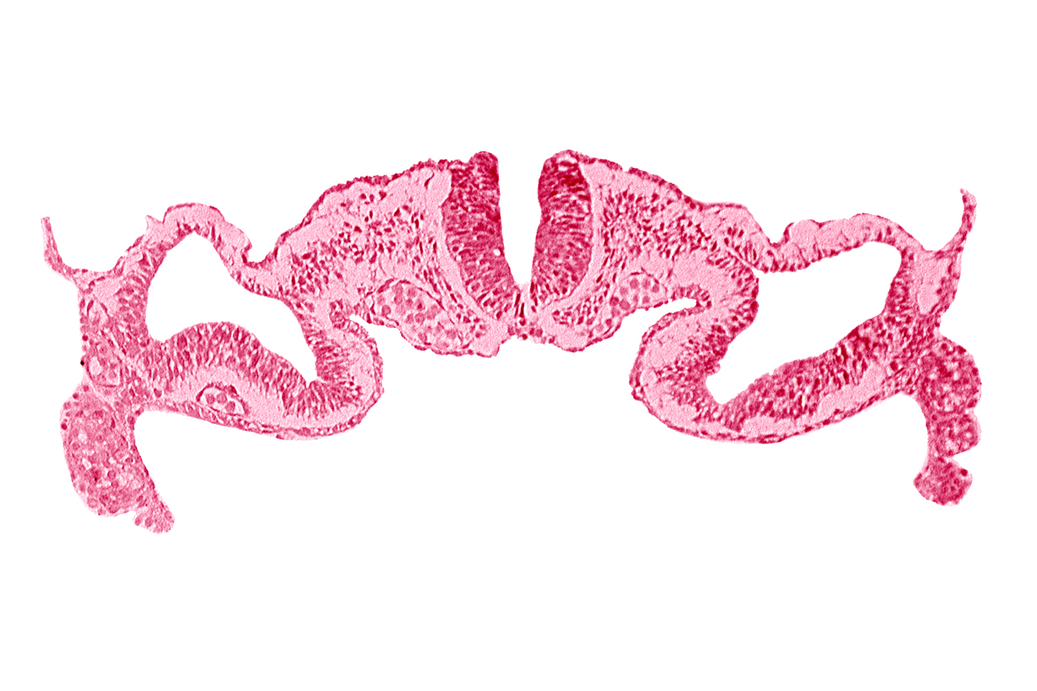 artifact separation(s), dorsal aorta, intermediate mesenchyme, midgut, neural fold [rhombencephalon (Rh. C)], paraxial mesoderm, presumptive right atrium, primordial peritoneal cavity, somatopleure, surface ectoderm, umbilical vesicle cavity