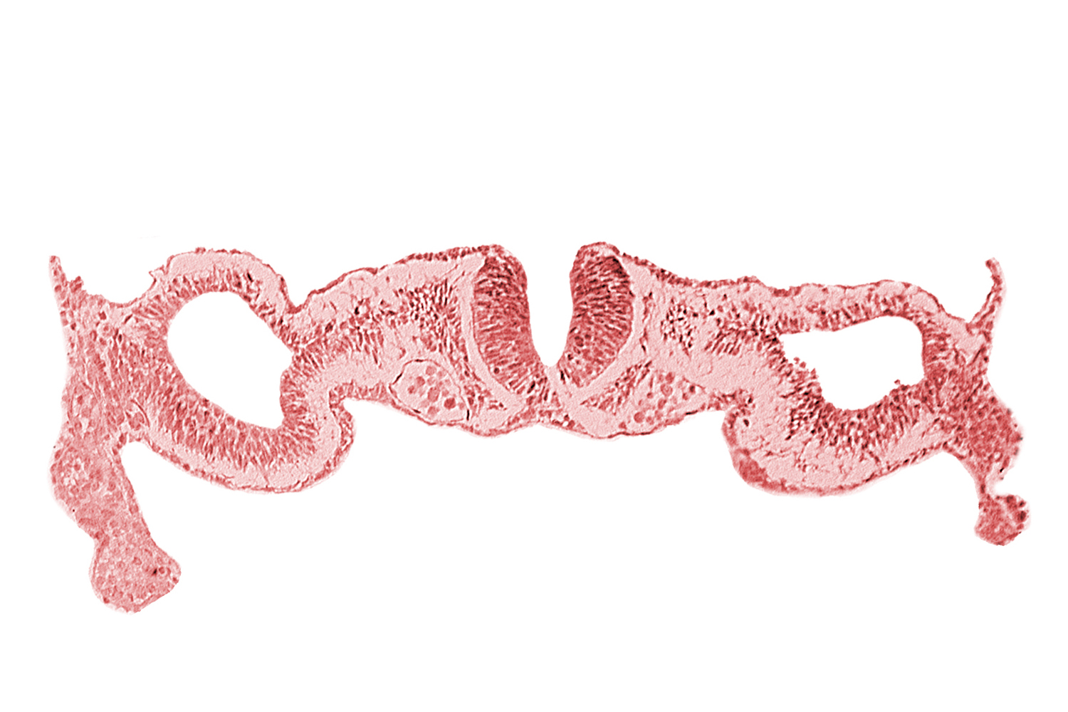 amnion attachment, artifact separation(s), cephalic edge of somite 1 (O-1), dorsal aorta, junction of neural ectoderm and surface ectoderm, junction of neural fold and surface ectoderm, midgut, neural fold [rhombencephalon (Rh. D)], primordial peritoneal cavity, umbilical vesicle wall