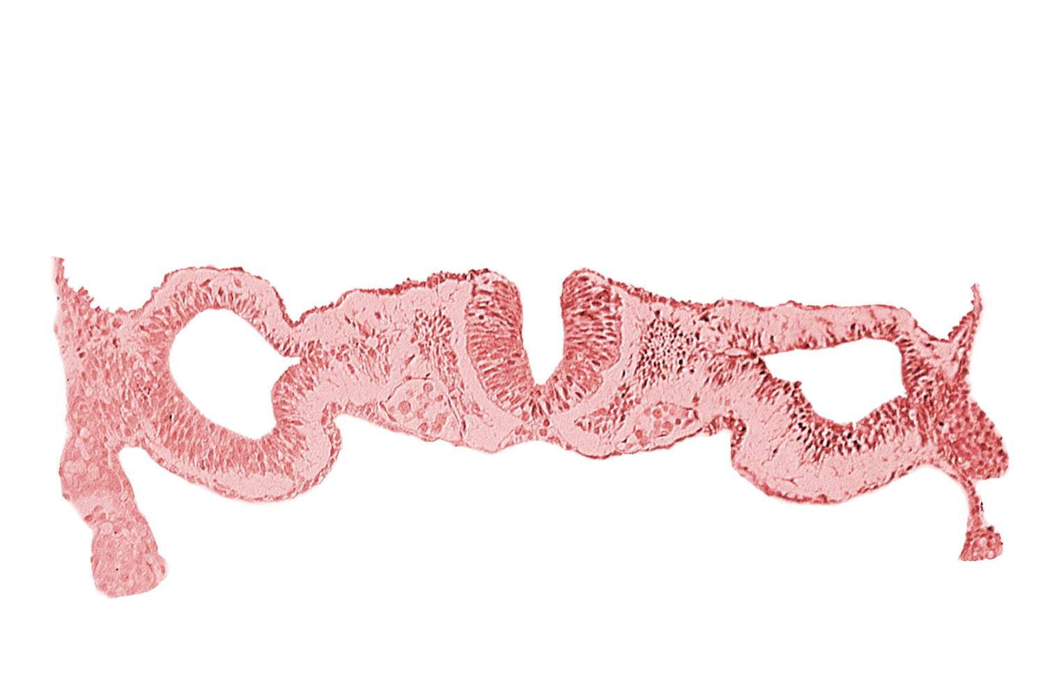 dorsal aorta, junction of neural ectoderm and surface ectoderm, junction of neural fold and surface ectoderm, midgut, neural fold [rhombencephalon (Rh. D)], notochordal plate, primordial peritoneal cavity, somite 1 (O-1)
