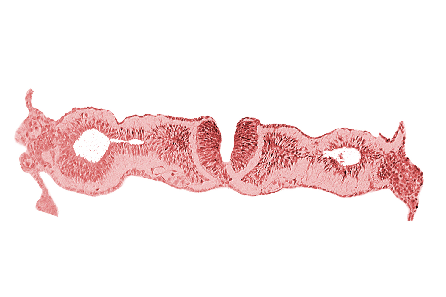 artifact separation(s), dorsal aorta, midgut, neural fold [rhombencephalon (Rh. D)], primordial peritoneal cavity, somite 1 (O-1)