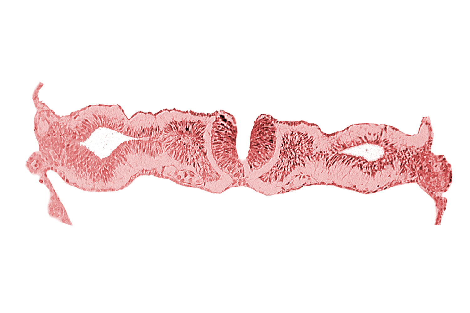 artifact separation(s), cephalic neuropore, dorsal aorta, primordial peritoneal cavity, somite 1 (O-1)