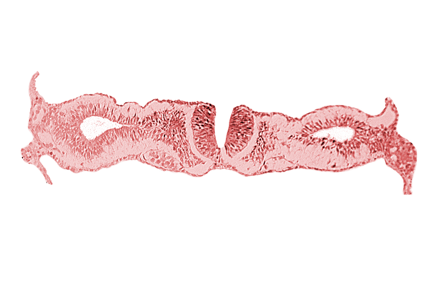 artifact separation(s), caudal end of somite 1 (O-1), dorsal aorta, neural fold [rhombencephalon (Rh. D)], primordial peritoneal cavity