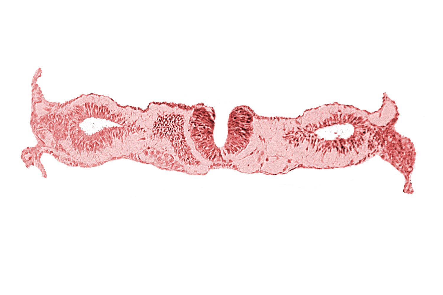 artifact separation(s), dorsal aorta, neural fold [rhombencephalon (Rh. D)], primordial peritoneal cavity, right umbilical vein, somite 1-2 intersegmental region