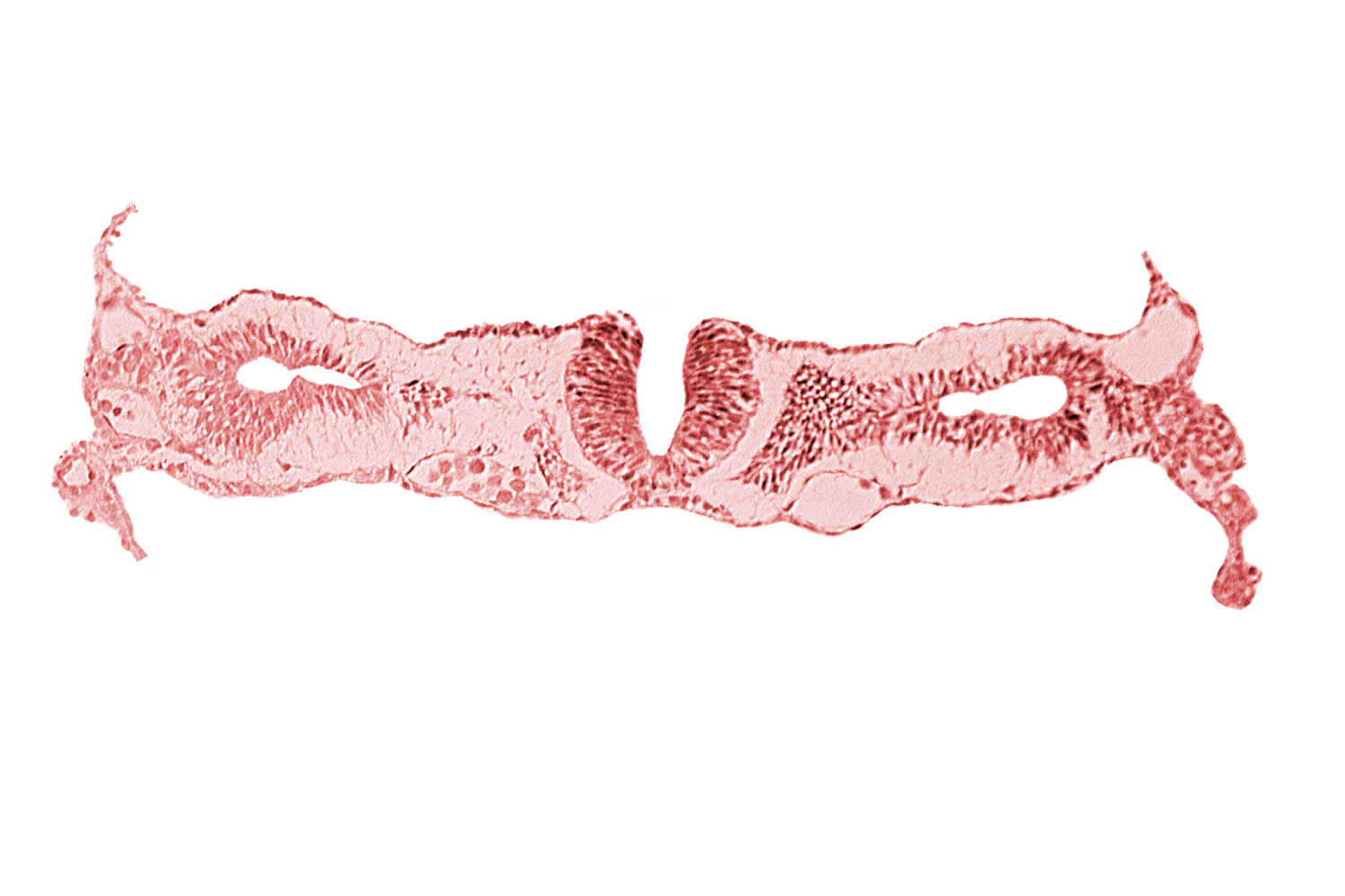 amnion, cephalic edge of somite 2 (O-2), dorsal aorta, midgut, neural fold [rhombencephalon (Rh. D)], primordial peritoneal cavity, right umbilical vein, umbilical vesicle wall