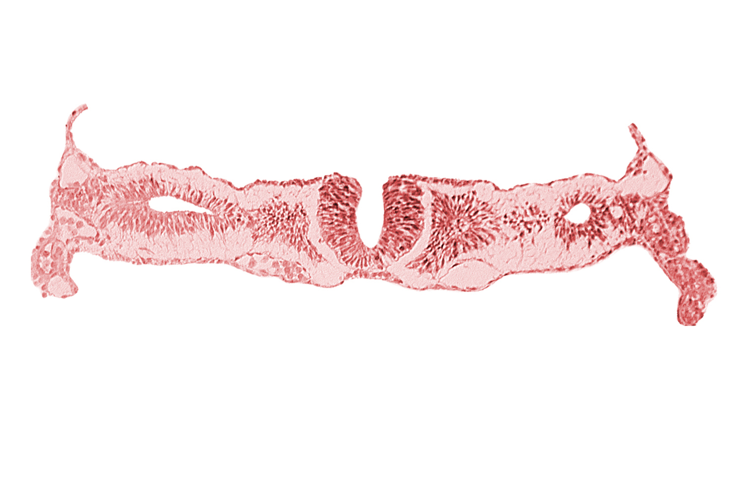 dorsal aorta, midgut, nephrogenic cord, neural fold [rhombencephalon (Rh. D)], primordial peritoneal cavity, right umbilical vein, somitocoel 2
