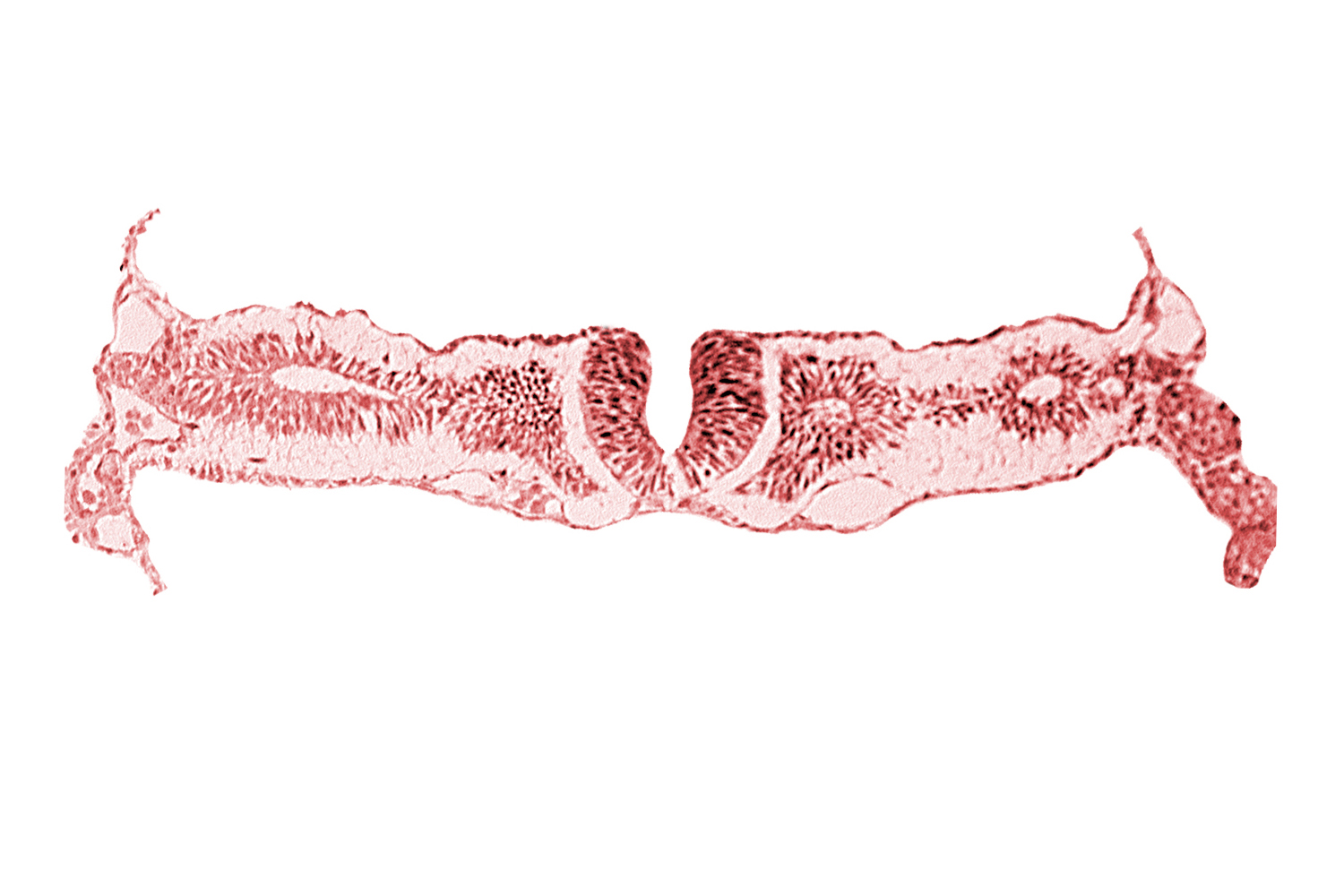 dorsal aorta, midgut, nephrogenic cord, neural fold [rhombencephalon (Rh. D)], primordial peritoneal cavity, right umbilical vein, somitocoel 2